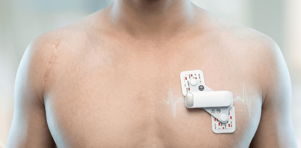 Holter Monitor